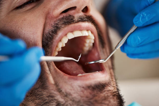 Best Teeth Whitening  in Butler, GA
