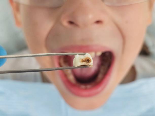 Best Emergency Dentist Open Today  in Butler, GA