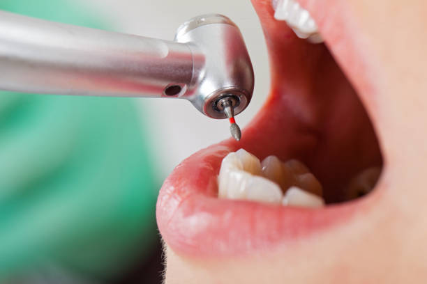 Best Tooth Infection Emergency Dentist  in Butler, GA